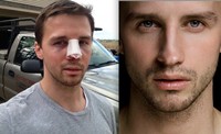 Simon Dexter Porn simon shocking before after pics gay porn star turned male escort dexters nose